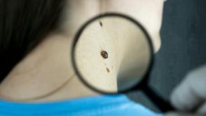 ALERT: HSE warn beauty treatment can increase skin cancer chances by 75%