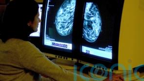 HSE says ‘problem’ with viewing BreastCheck register will be fixed next week