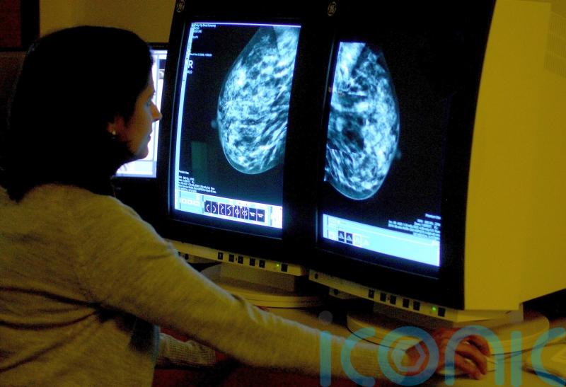 HSE says ‘problem’ with viewing BreastCheck register will be fixed next week